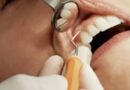 डेंटल इलाज ने किया चमत्कार: 20 साल बाद लौटी सुनने की शक्ति, डॉक्टर भी रह गए हैरान